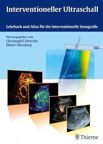 Interventioneller Ultraschall: Lehrbuch und Atlas für die Interventionelle Sonografie: Lehrbuch und Atlas für die interventionelle Sonographie von Georg Thieme Verlag
