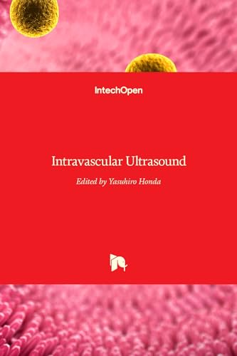 Intravascular Ultrasound von IntechOpen