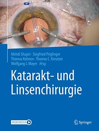 Katarakt- und Linsenchirurgie: in der Augenheilkunde Katarakt- und Linsenchirurgie: in der Augenheilkunde