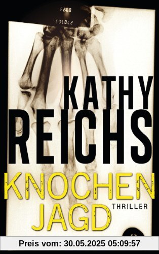 Knochenjagd