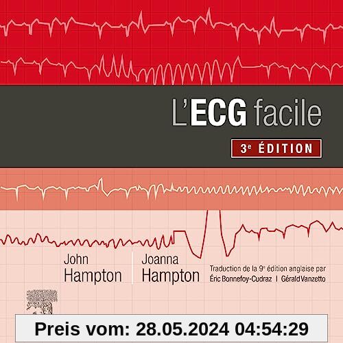 L'ECG facile