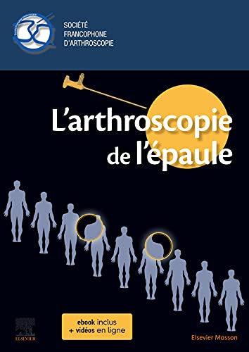L'arthroscopie de l'épaule L'arthroscopie de l'épaule von MASSON