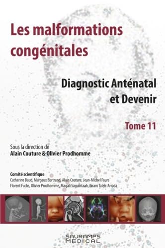 LES MALFORMATIONS CONGENITALES T.11-DIAGNOSTIC ANTENATAL ET DEVENIR: Diagnostic anténatal et devenir Tome 11 von SAURAMPS MEDICA
