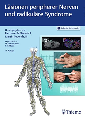 Läsionen peripherer Nerven und radikuläre Syndrome von Thieme