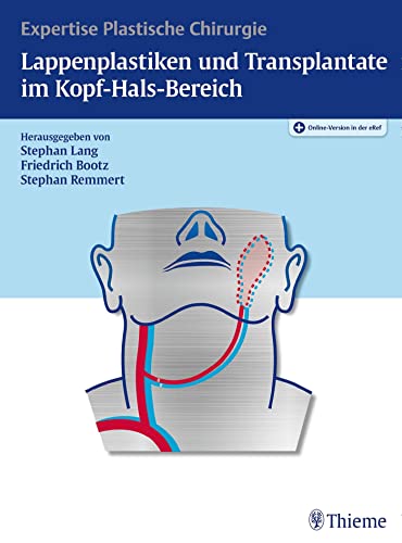 Lappenplastiken und Transplantate im Kopf-Hals-Bereich: Expertise Plastische Chirurgie von Thieme