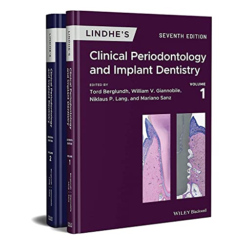 Lindhe's Clinical Periodontology and Implant Dentistry, 2 Volume Set Lindhe's Clinical Periodontology and Implant Dentistry, 2 Volume Set von Wiley-Blackwell