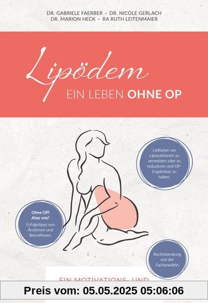 Lipödem - Ein Leben ohne OP: Ein Motivations- und Aufklärungsratgeber