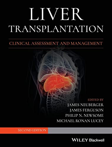 Liver Transplantation: Clinical Assessment and Management Liver Transplantation: Clinical Assessment and Management
