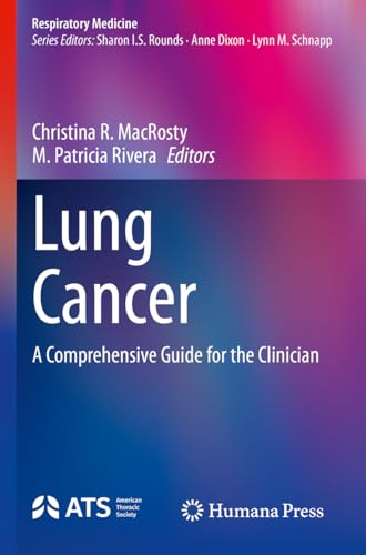 Lung Cancer: A Comprehensive Guide for the Clinician (Respiratory Medicine) von Humana