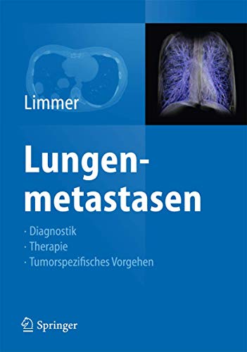 Lungenmetastasen: Diagnostik - Therapie - Tumorspezifisches Vorgehen von Springer