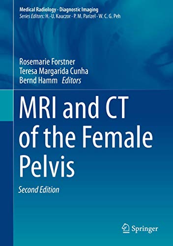 MRI and CT of the Female Pelvis (Medical Radiology) von Springer
