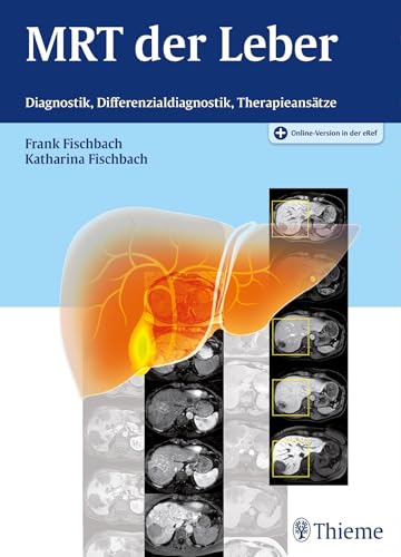 MRT der Leber: Diagnostik, Differenzialdiagnostik, Therapieansätze von Georg Thieme Verlag