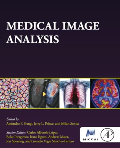 Medical Image Analysis (The MICCAI Society book Series) von Academic Press