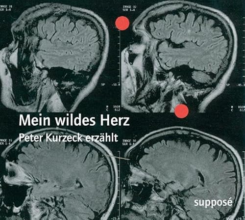 Mein wildes Herz: Peter Kurzeck erzählt von Suppos