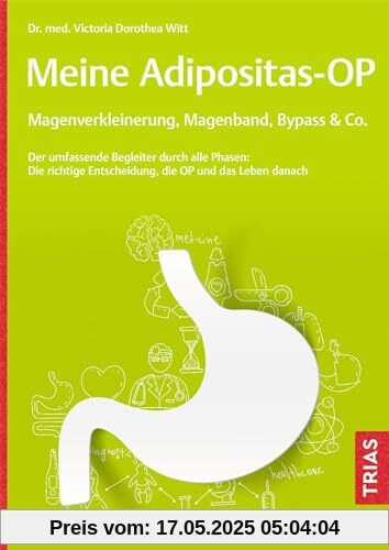 Meine Adipositas-OP. Magenverkleinerung, Magenband, Bypass & Co.: Der umfassende Begleiter durch alle Phasen: Die richtige Entscheidung, die OP und das Leben danach