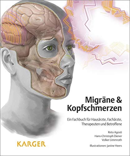 Migräne und Kopfschmerzen: Ein Fachbuch für Hausärzte, Fachärzte, Therapeuten und Betroffene von S. Karger