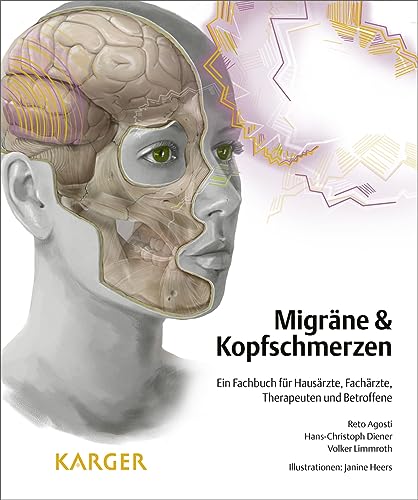 Migräne und Kopfschmerzen: Ein Fachbuch für Hausärzte, Fachärzte, Therapeuten und Betroffene von S. Karger