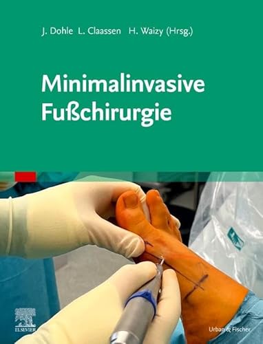 Minimalinvasive Fußchirurgie von Urban & Fischer Verlag/Elsevier GmbH