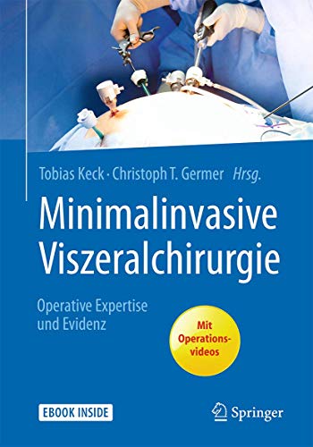 Minimalinvasive Viszeralchirurgie: Operative Expertise und Evidenz