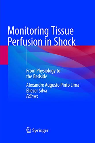 Monitoring Tissue Perfusion in Shock: From Physiology to the Bedside Monitoring Tissue Perfusion in Shock: From Physiology to the Bedside von Springer