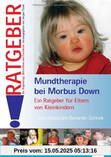 Mundtherapie bei morbus Down: Ein Ratgeber für Eltern von Kleinkindern Mundtherapie bei morbus Down: Ein Ratgeber für Eltern von Kleinkindern