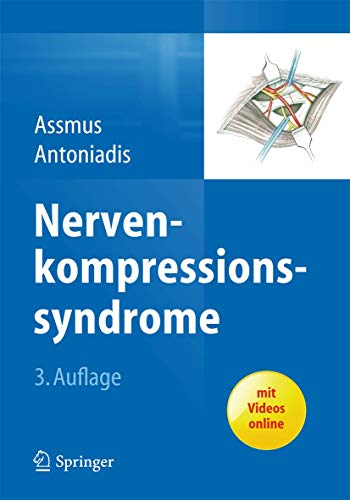 Nervenkompressionssyndrome: Mit Videos online