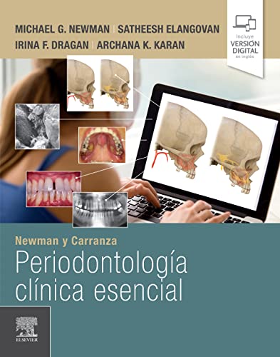 Newman y Carranza. Periodontología clínica esencial von Elsevier
