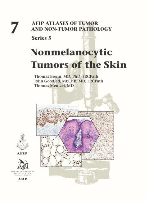 Nonmelanocytic Tumors of the Skin (AFIP Atlas of Tumor and Non-Tumor Pathology, Series 5, Band 7)