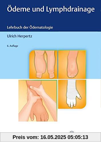 Ödeme und Lymphdrainage: Diagnose und Therapie