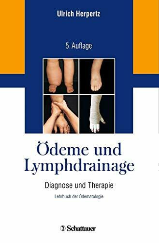 Ödeme und Lymphdrainage: Diagnose und Therapie – Lehrbuch der Ödematologie Ödeme und Lymphdrainage: Diagnose und Therapie – Lehrbuch der Ödematologie