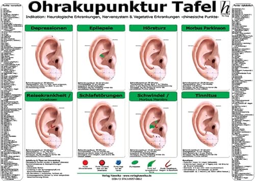 Ohrakupunktur Tafel - Indikation: Neurologische Erkrankungen, Nervensystem & Vegetative Erkrankungen Ohrakupunktur Tafel - Indikation: Neurologische Erkrankungen, Nervensystem & Vegetative Erkrankungen von Hawelka Verlag