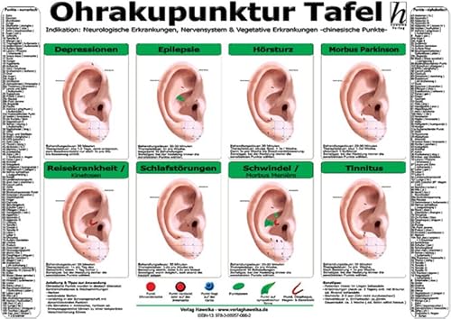 Ohrakupunktur Tafel - Indikation: Neurologische Erkrankungen, Nervensystem & Vegetative Erkrankungen