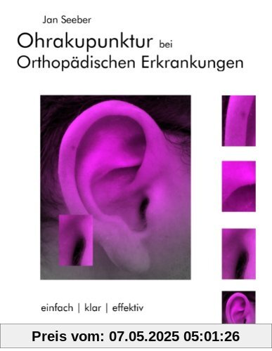 Ohrakupunktur bei Orthopädischen Erkrankungen: Balancierte Ohrakupunktur: einfach, klar, effektiv Ohrakupunktur bei Orthopädischen Erkrankungen: Balancierte Ohrakupunktur: einfach, klar, effektiv