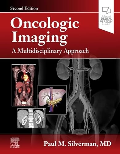 Oncologic Imaging: A Multidisciplinary Approach: Expert Consult - Online and Print von Saunders