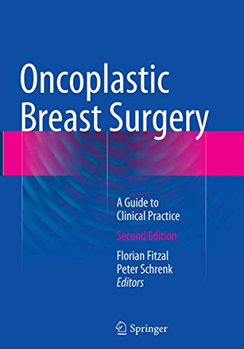 Oncoplastic Breast Surgery: A Guide to Clinical Practice Oncoplastic Breast Surgery: A Guide to Clinical Practice von Springer