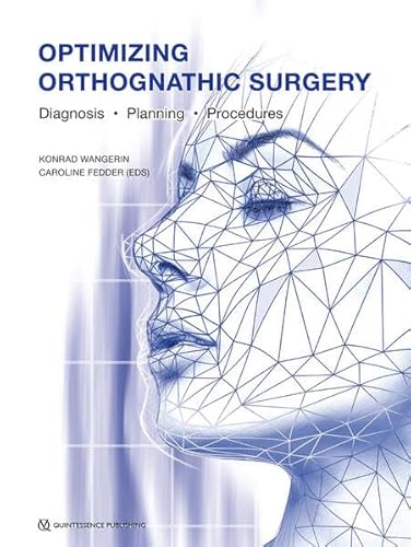 Optimizing Orthognathic Surgery: Diagnosis, Planning, Procedures von Quintessence Publishing
