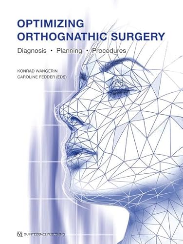 Optimizing Orthognathic Surgery: Diagnosis, Planning, Procedures