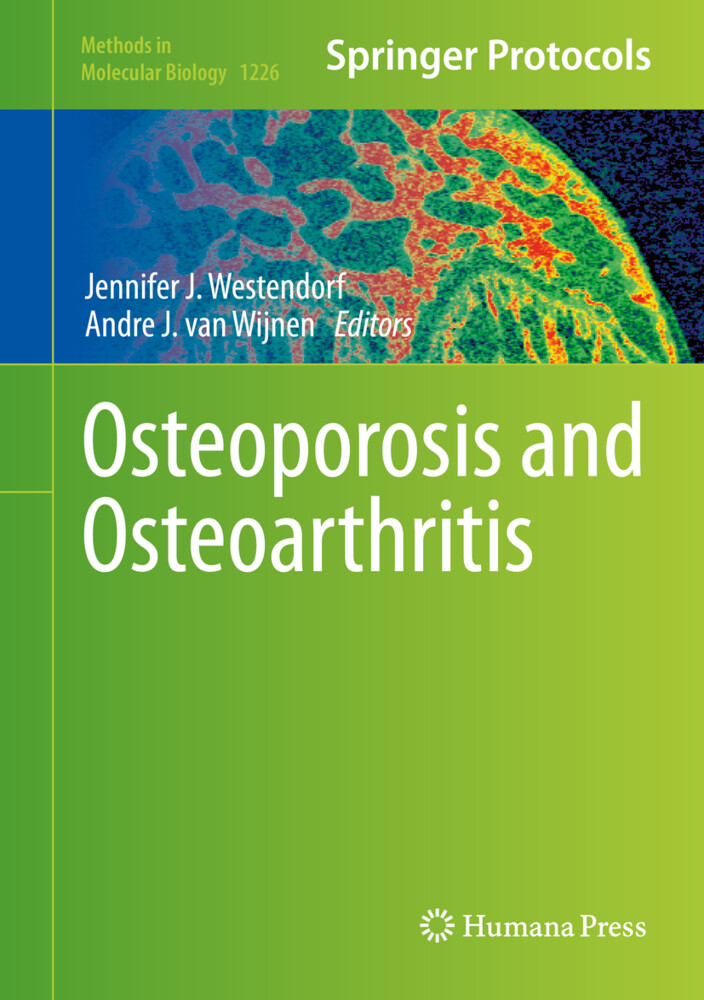 Osteoporosis von Springer-Verlag GmbH