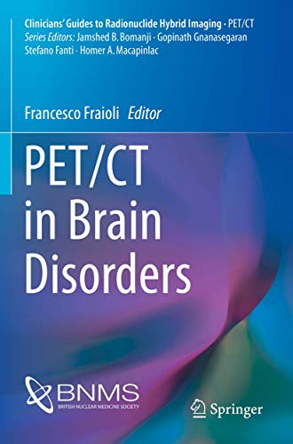 PET/CT in Brain Disorders (Clinicians’ Guides to Radionuclide Hybrid Imaging) von Springer