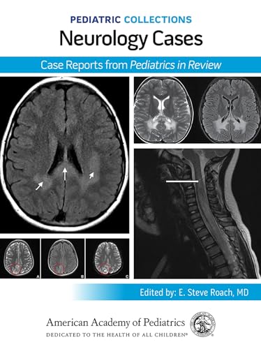 Pediatric Collections: Neurology Cases: Case Reports from Pediatrics in Review