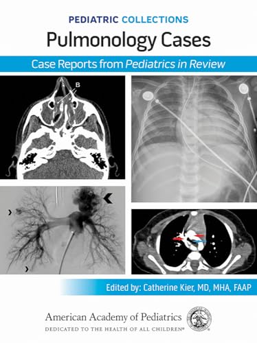 Pediatric Collections: Pulmonology Cases: Case Reports from Pediatrics in Review Pediatric Collections: Pulmonology Cases: Case Reports from Pediatrics in Review von American Academy of Pediatrics