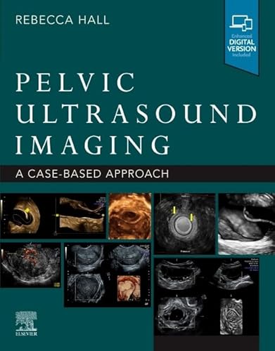Pelvic Ultrasound Imaging: A Cased-Based Approach von Elsevier