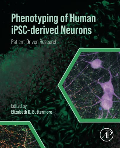 Phenotyping of Human iPSC-derived Neurons: Patient-Driven Research von Academic Press