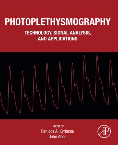 Photoplethysmography: Technology, Signal Analysis and Applications von Academic Press