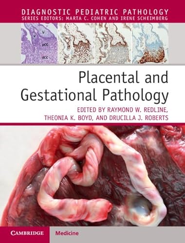 Placental and Gestational Pathology (Diagnostic Pediatric Pathology) von Cambridge University Press