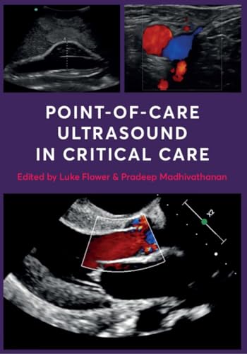 Point-Of-Care Ultrasound in Critical Care (Anaesthesia)
