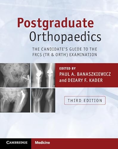 Postgraduate Orthopaedics: The Candidate's Guide to the FRCS (TR & Orth) Examination von Cambridge University Press