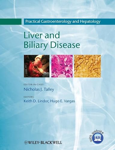 Practical Gastroenterology and Hepatology: Liver and Biliary Disease