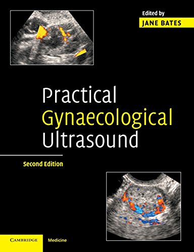 Practical Gynaecological Ultrasound von Cambridge University Press