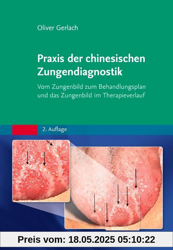 Praxis der chinesischen Zungendiagnostik: Vom Zungenbild zum Behandlungsplan und das Zungenbild im Therapieverlauf